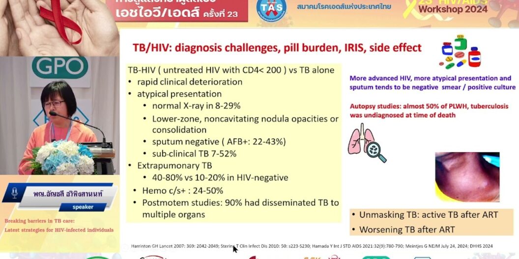 Breaking barriers in TB care