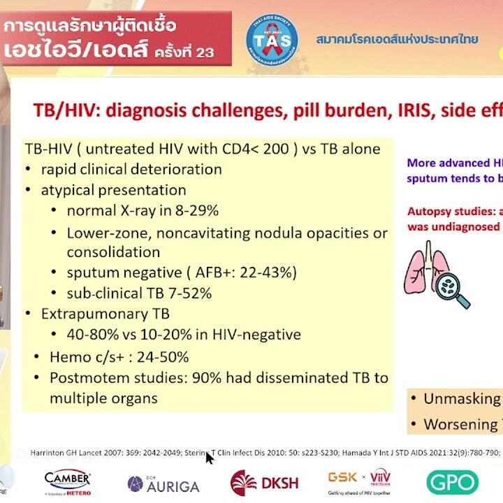 Breaking barriers in TB care