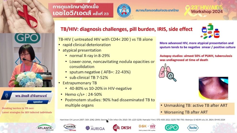 Breaking barriers in TB care