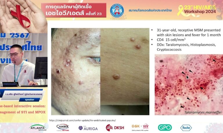 Management of STI and MPOX