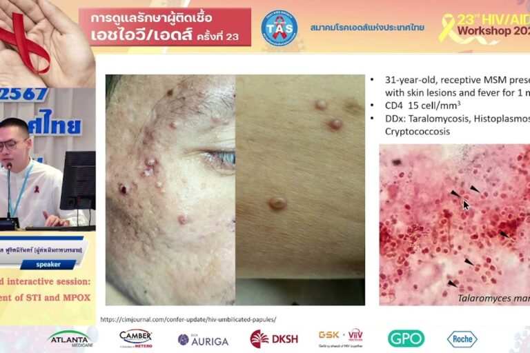 Management of STI and MPOX