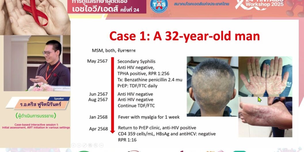 Initial assessment, ART initiation in various settings