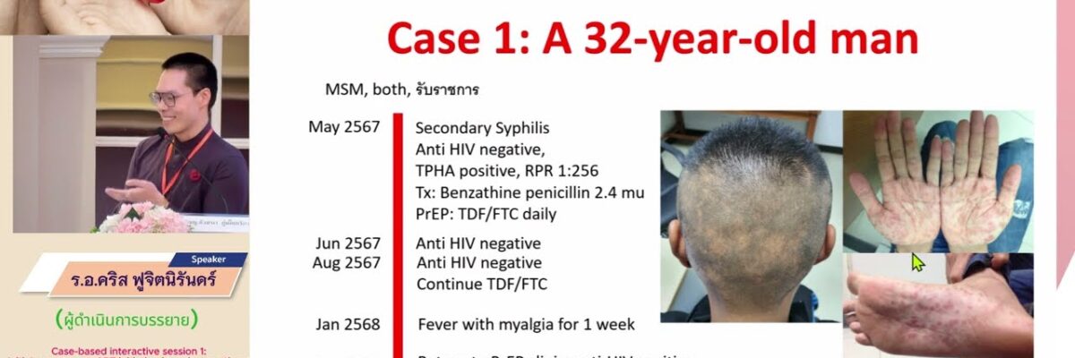 Initial assessment, ART initiation in various settings