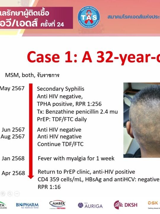 Initial assessment, ART initiation in various settings