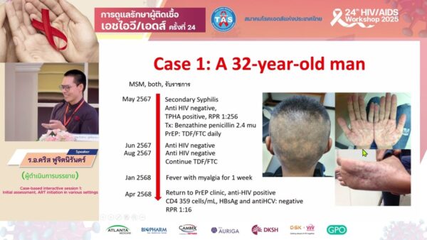 Initial assessment, ART initiation in various settings