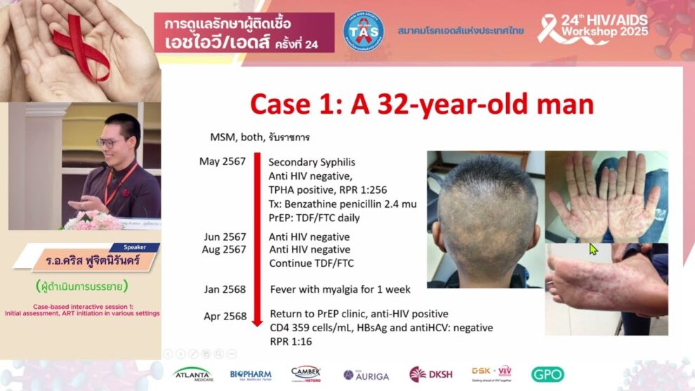 Initial assessment, ART initiation in various settings