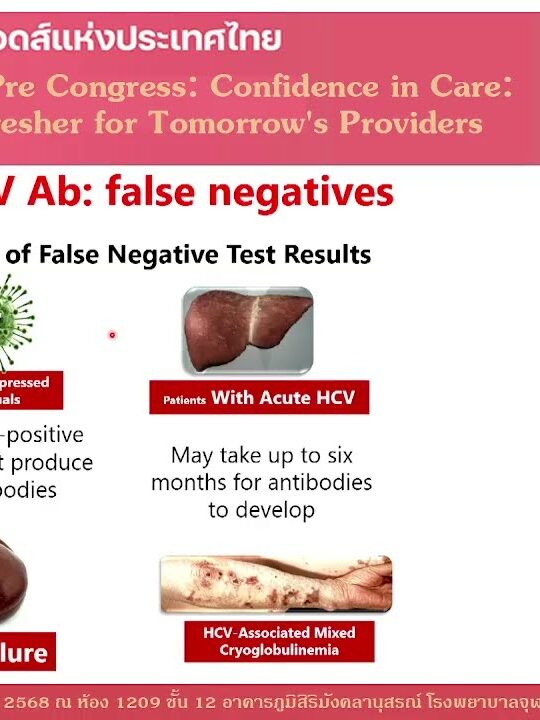 Management of hepatitis C in PWH