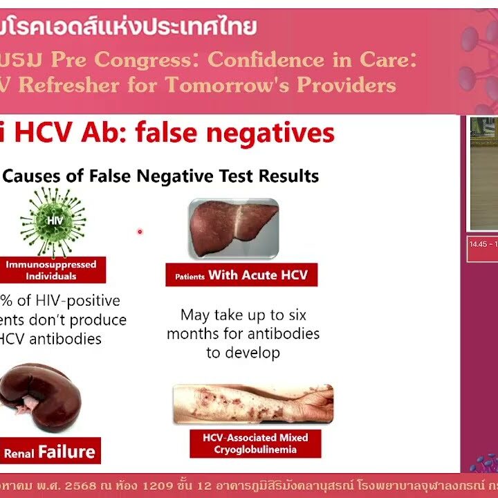 Management of hepatitis C in PWH