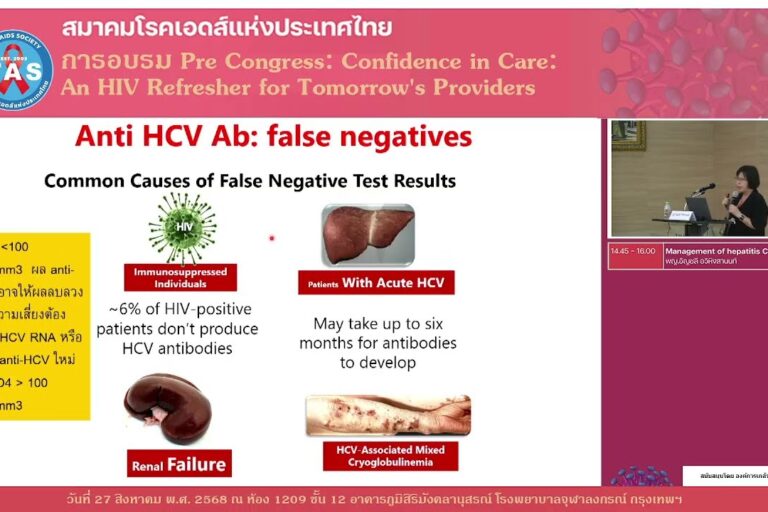 Management of hepatitis C in PWH