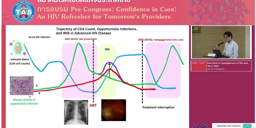 Overview in management of OIs and TB in PWH