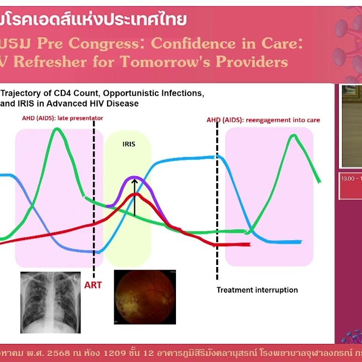 Overview in management of OIs and TB in PWH