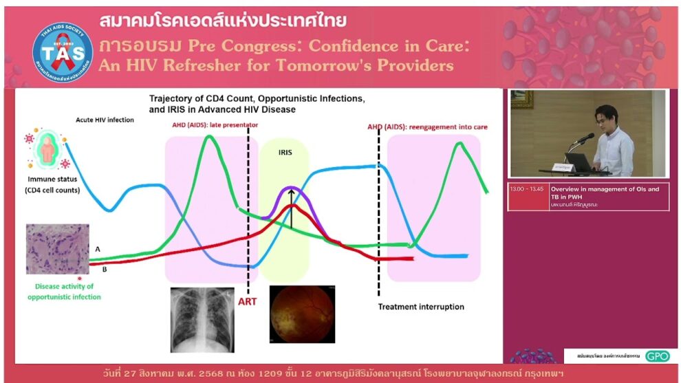 Overview in management of OIs and TB in PWH